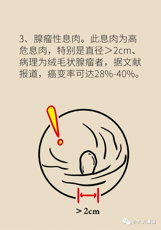 怎样防止胃息肉演变成胃癌(胃息肉是不是胃癌先兆)(22)