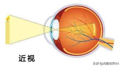 为什么你的眼睛那么动人（你的眼睛有哪些秘密）(2)