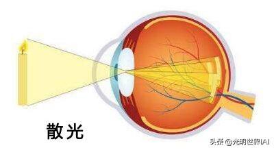 为什么你的眼睛那么动人（你的眼睛有哪些秘密）(4)